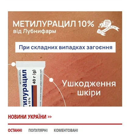 баннерная реклама на сайте – горизонтальный баннер над новостным блоком